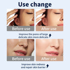 Wireless LED Light Therapy Face & Neck Mask with  7 Colors