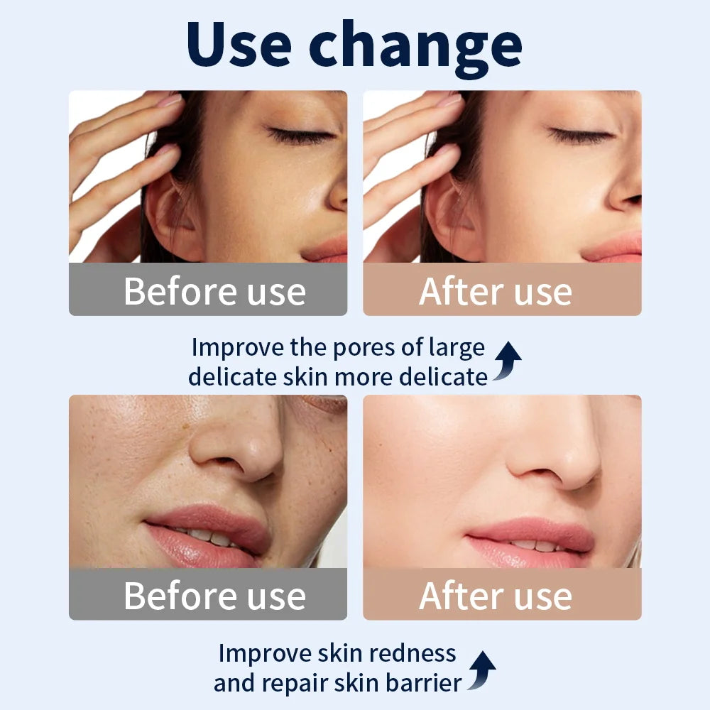 Wireless LED Light Therapy Face & Neck Mask with  7 Colors