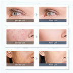 LED Light Therapy Face & Neck Mask with 7 Colors