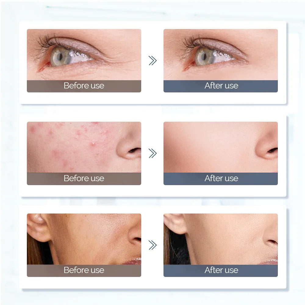 LED Light Therapy Face & Neck Mask with 7 Colors